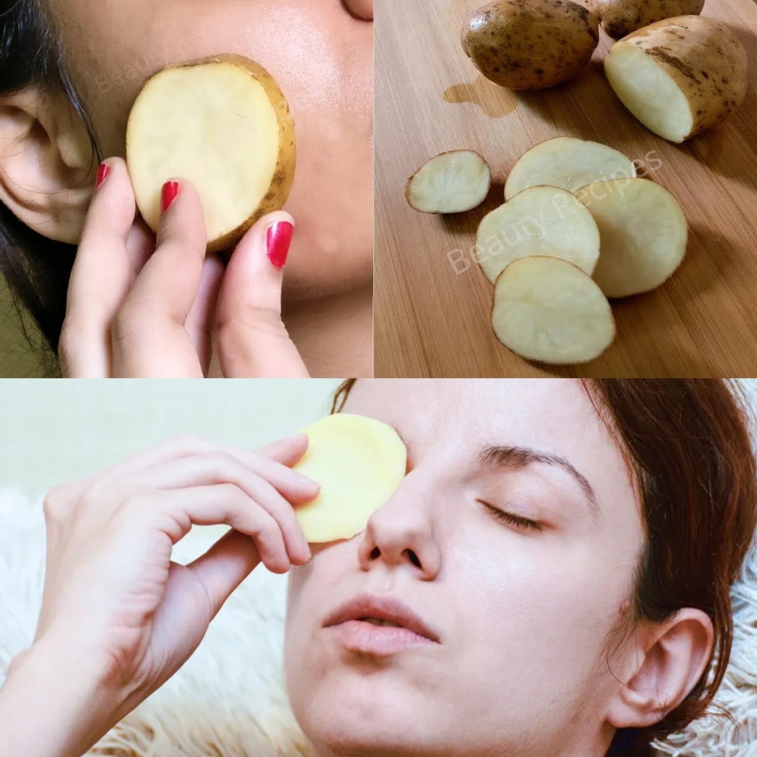 I Rubbed Potato on My Face & It Removed My Dark Spots and Hyperpigmentation in 30 Days!