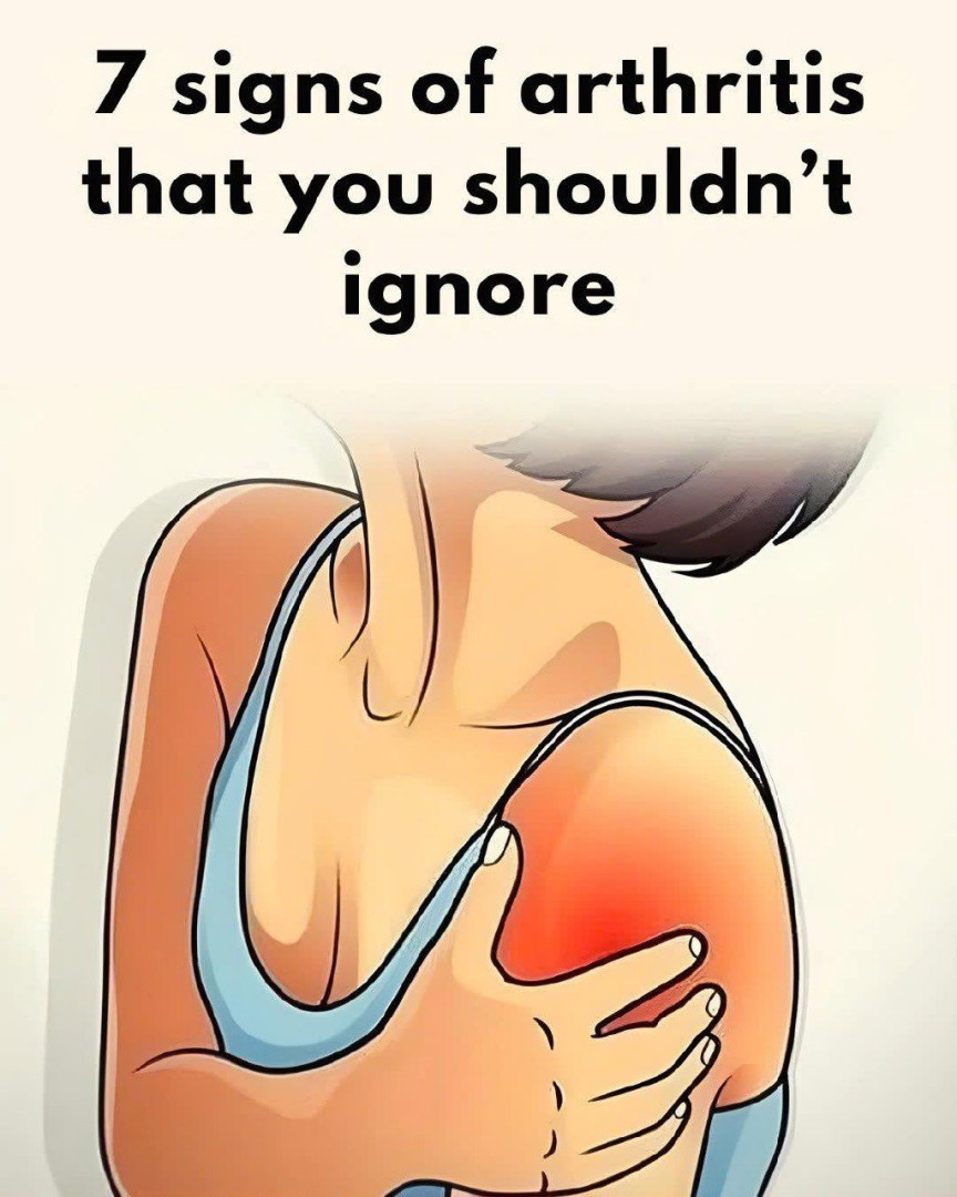 7 Signs of Arthritis to Know