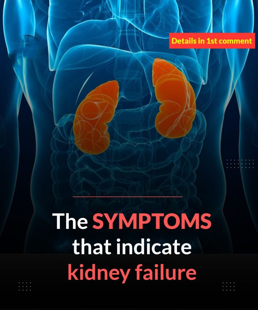 The first SYMPTOMS that w:arn of kidney failure, DO NOT ignore them!