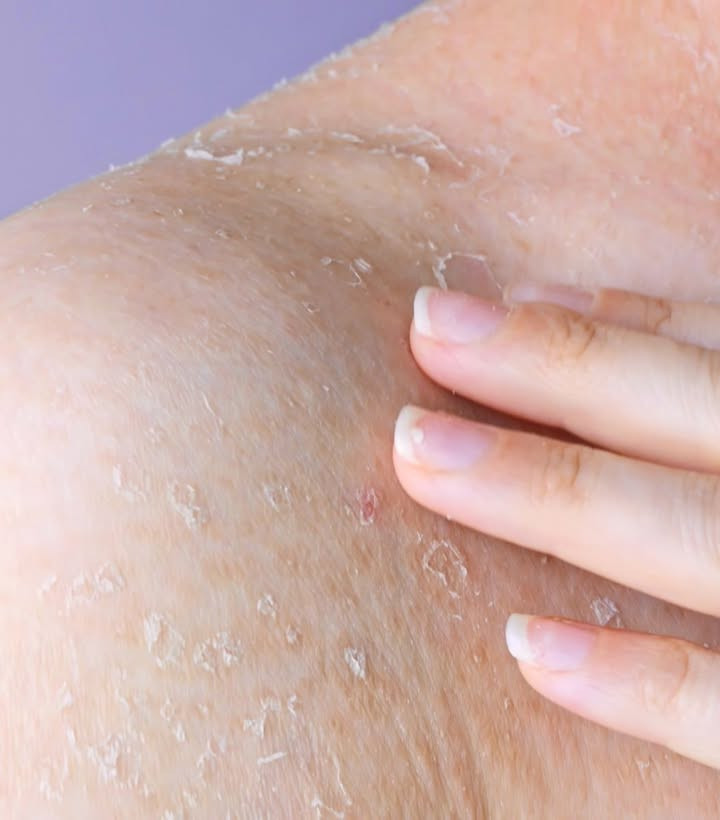 My skin is so flaky and itchy all over. Can’t consult a doctor right away. What’s the best quick fix?