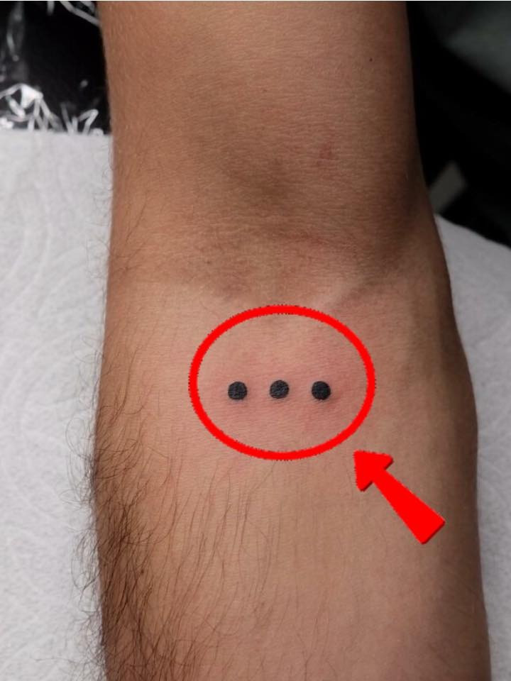 The ‘three-dot tattoo’ – potential meaning and significance