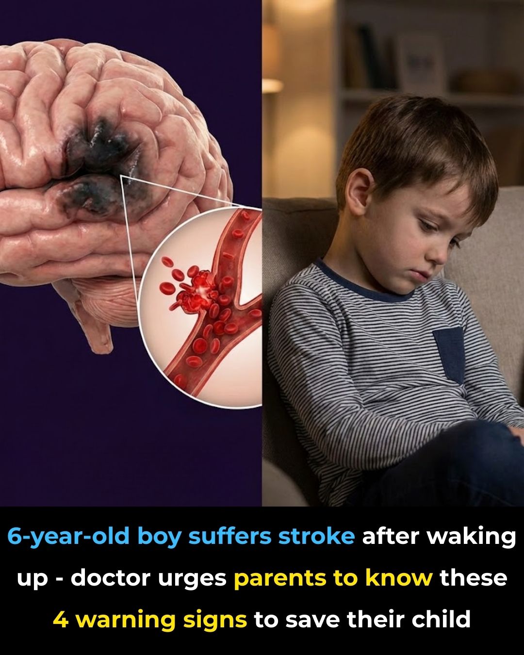 6-Year-Old Boy Suffers Stroke After Waking Up – Doctor Urges Parents to Know These 4 Warning Signs to Save Their Child