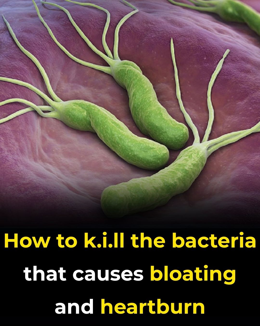 How to Treat H. Pylori (Helicobacter Pylori) Naturally Without Antibiotics