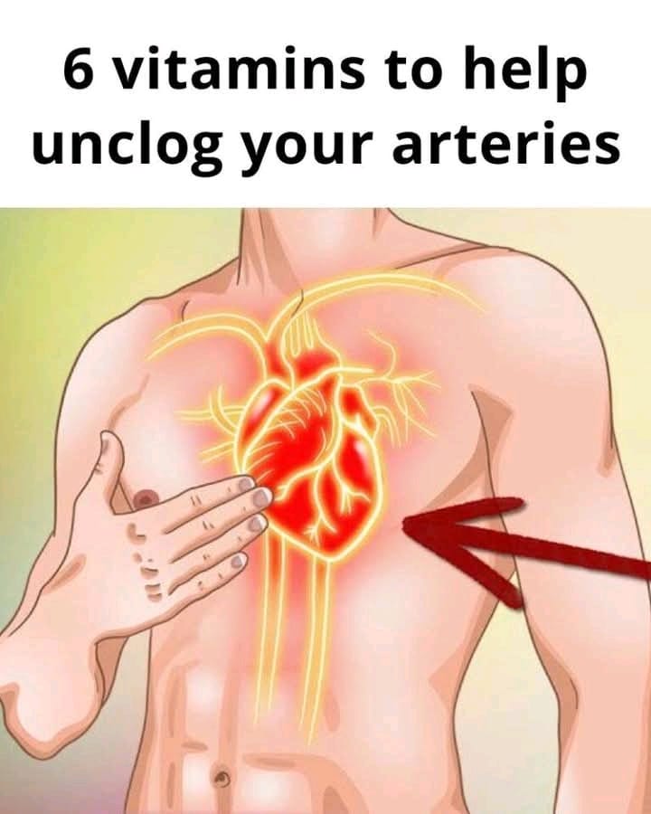 6 Vitamins to Unclog Your Arteries